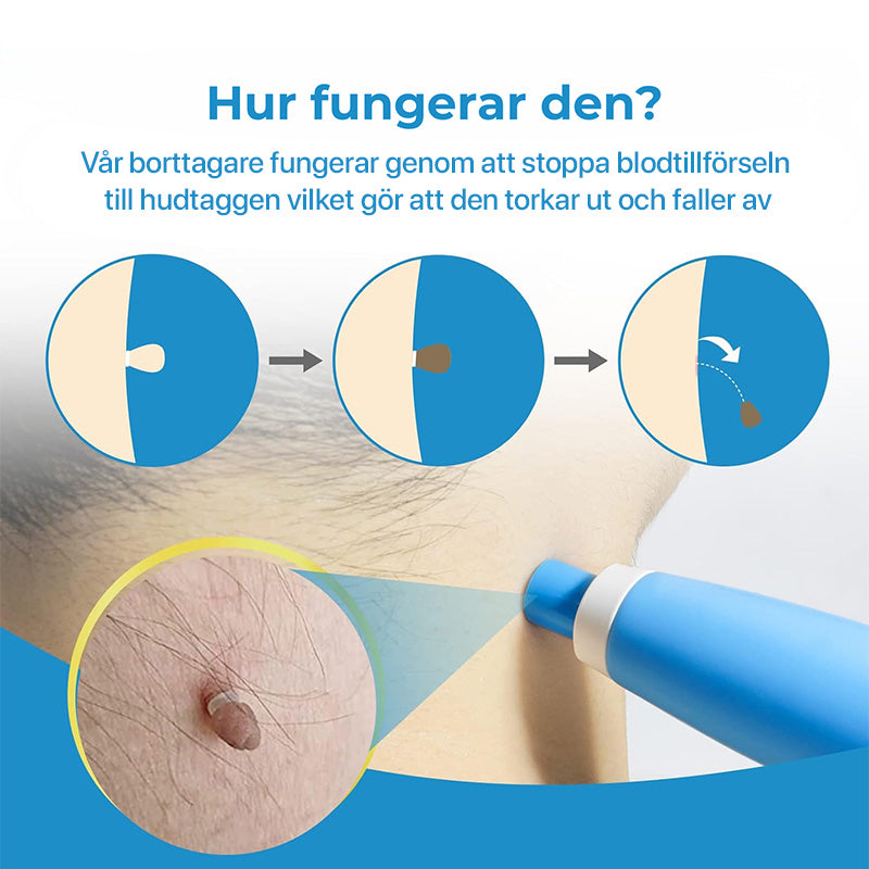 Hudfliksborttagare