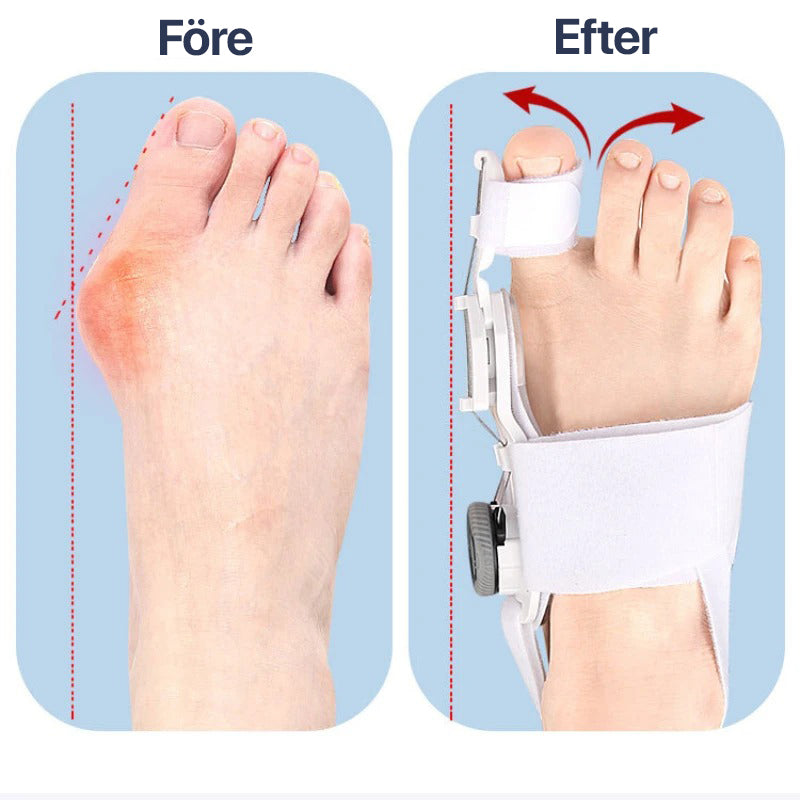 Justerbar Hallux Valgus-Korrigerare