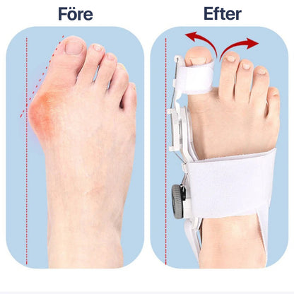 Justerbar Hallux Valgus-Korrigerare